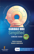 CARDIAC MRI Simplified CONCISE GUIDE