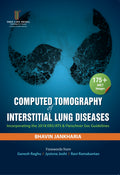 Computed Tomography of Interstitial Lung Diseases